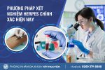 Xét nghiệm mụn rộp sinh dục nhanh và chính xác ở đâu?