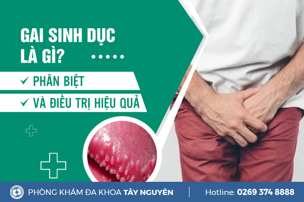 Tìm hiểu về bệnh gai sinh dục ở nam và nữ giới