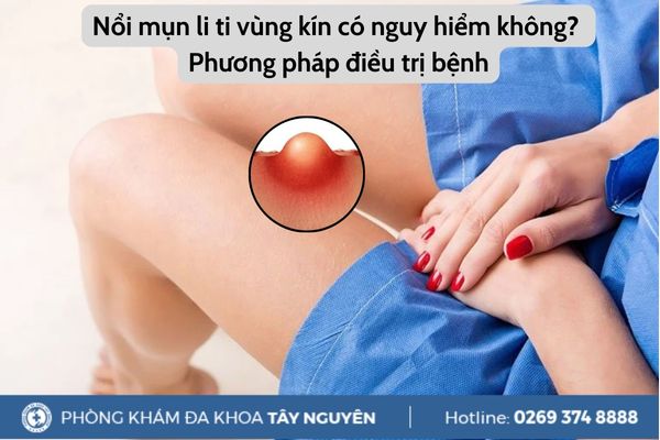 Nổi mụn li ti vùng kín có nguy hiểm không? Phương pháp điều trị bệnh