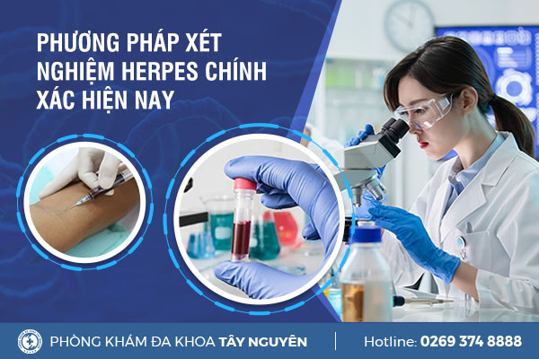 Xét nghiệm mụn rộp sinh dục nhanh và chính xác ở đâu?